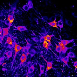 „Lebende Neuronen in Hirnschnitten, aufgenommen mit dem Zwei-Photonen-Mikroskop; fluoreszierendes GCaMP zeigt Calciumaktivität.