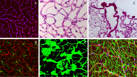 Pericytes in retinal deep capillary layer 