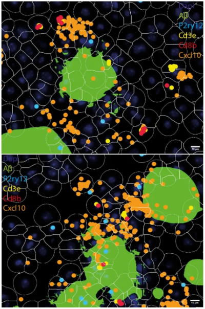 Spatial RNA expression of Cxcl10 (orange) in representative brain regions of a mouse model with an Alzheimer’s-like condition, located in proximity to amyloid plaques (green). 