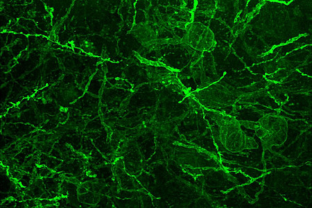 Figure: Visualization of a GPCR ligand in nerve cells