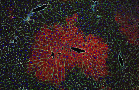 Das Foto zeigt eine wissenschaftliche Aufnahme, einen Leberschnitt, der unterschiedliche Zonen erkennen lässt.